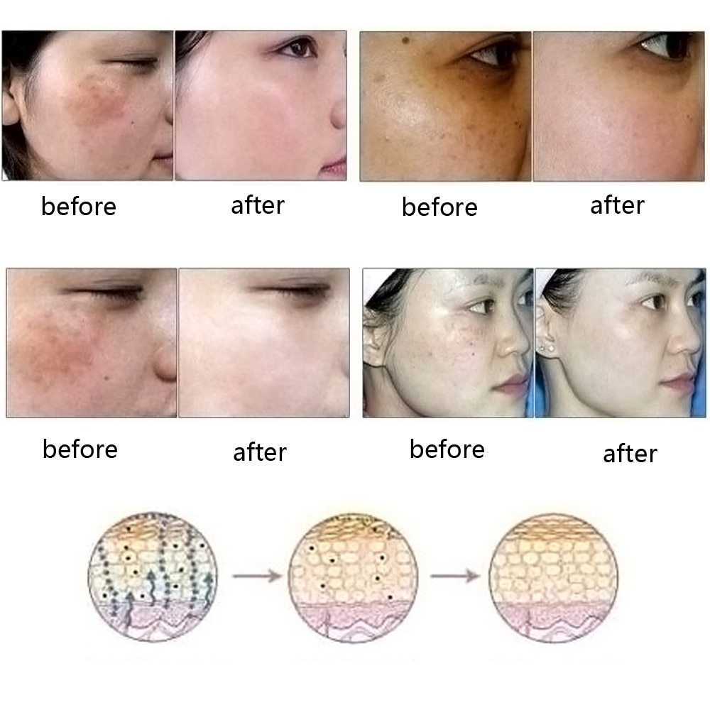 Ultra Brightening Oil – Dark Spot & Stretch Mark Repair with Herbal Extracts