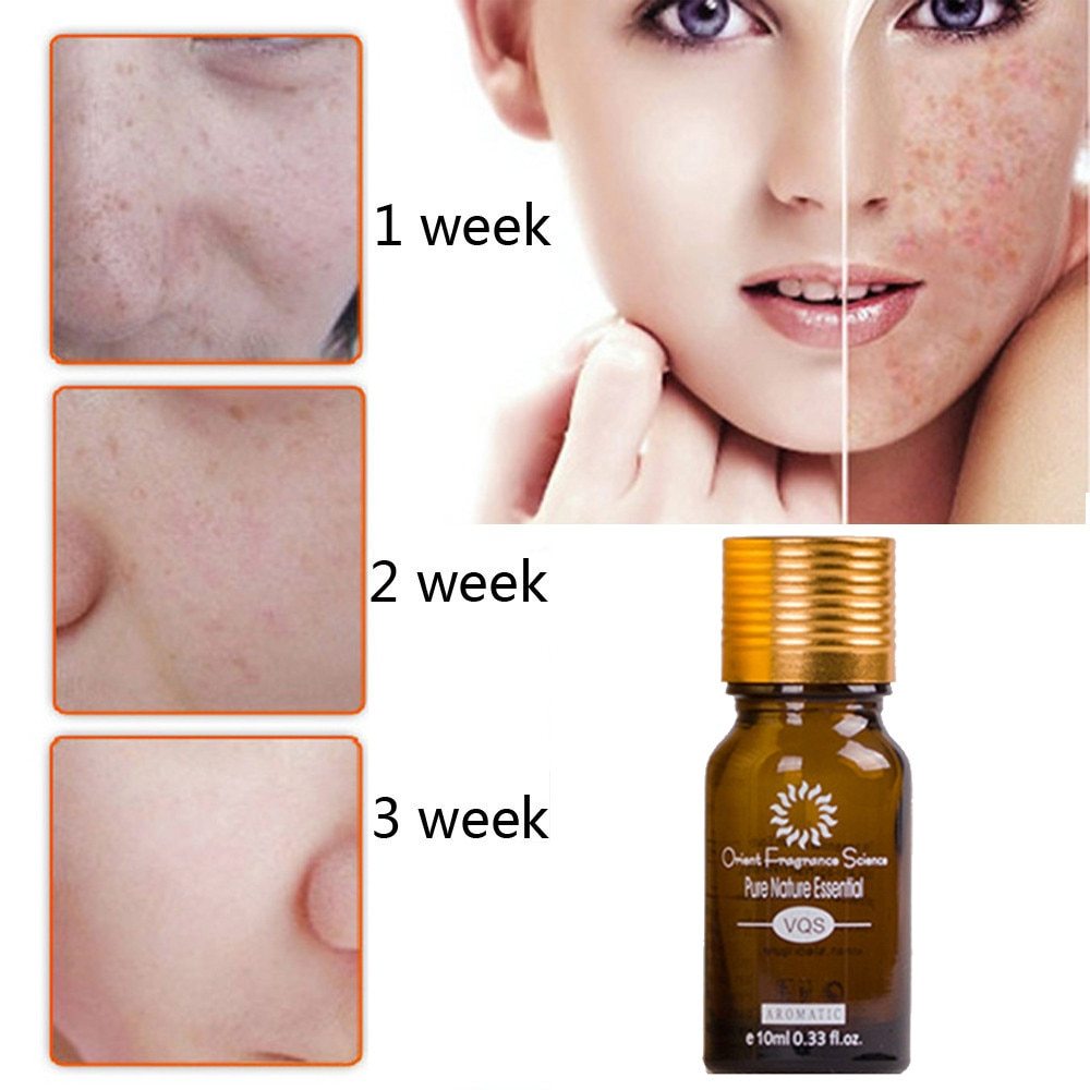 Ultra Brightening Oil – Dark Spot & Stretch Mark Repair with Herbal Extracts