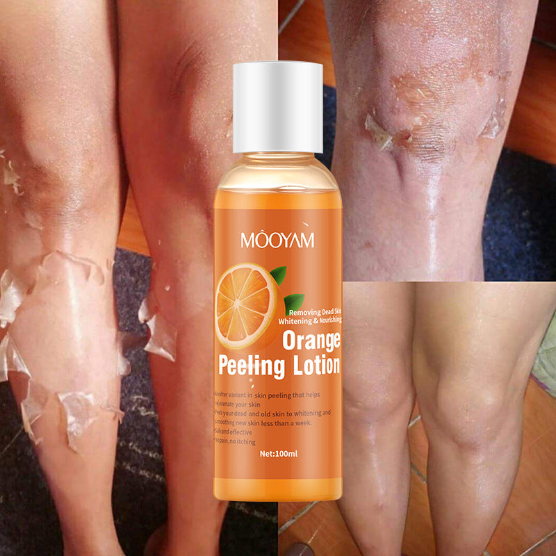 MOOYAM Orange Peel Lotion – Gentle Peeling Oil Body Lotion for Skin