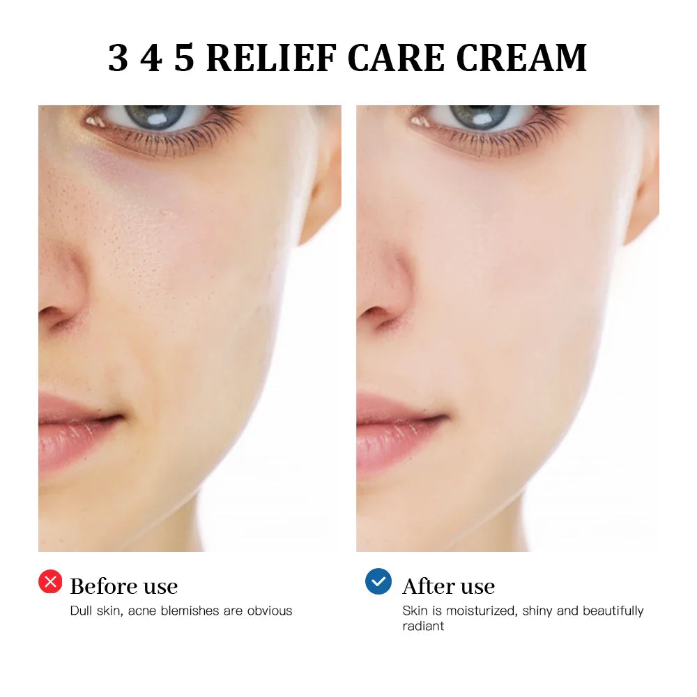 Reveal Radiant Skin with the Long Lasting Moisturizer Korean Cream