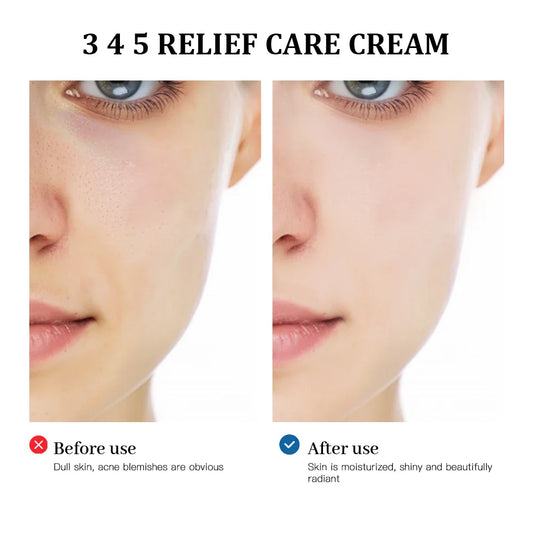 Reveal Radiant Skin with the Long Lasting Moisturizer Korean Cream