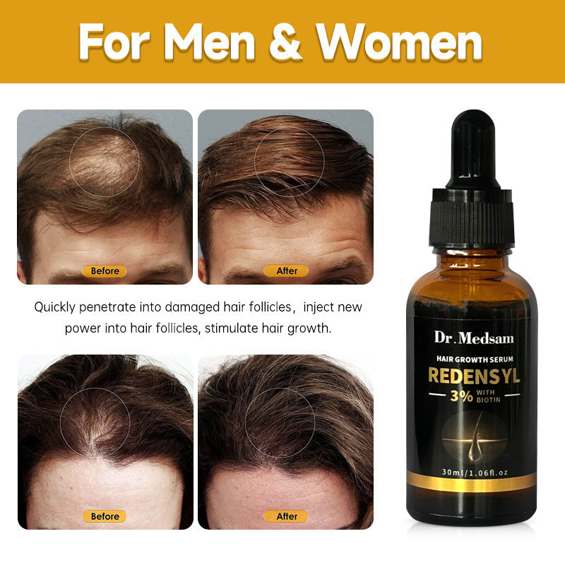 Biotin & Rosemary Hair Growth Oil – Strengthens, Thickens Hair Naturally