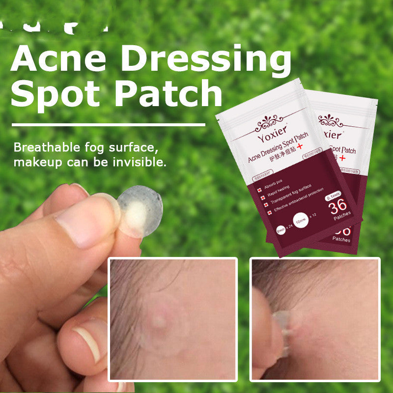 Invisible Acne Spot Patch Set – Pimple Remover & Blemish Treatment