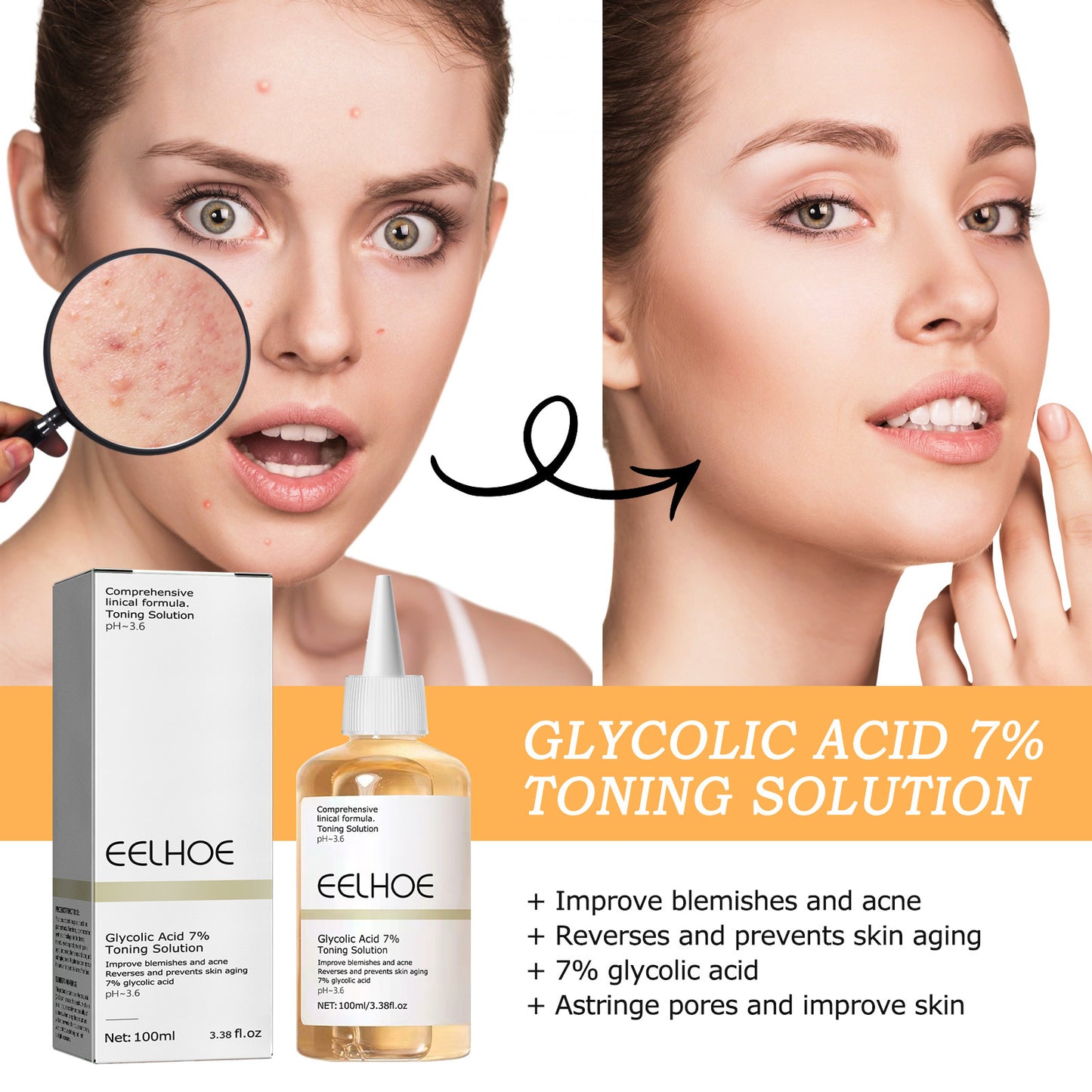Glycolic Acid 7 Lotion 7 Acne Removing Closed Mouth