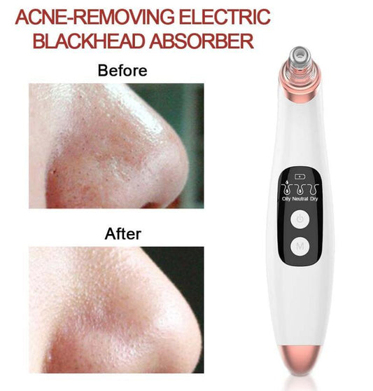 USB Electric Blackhead Remover – Visual Pore Cleaner with LED Display
