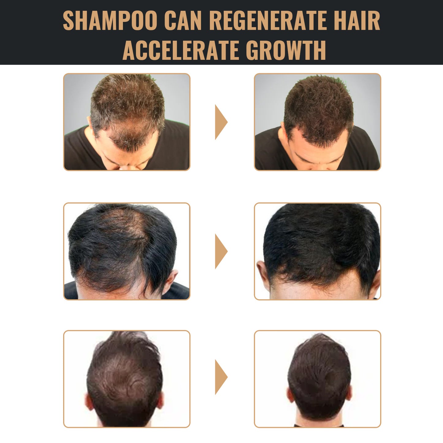 Root Activator Hair Regrowth Shampoo – Natural Thickening & Nourishing Formula