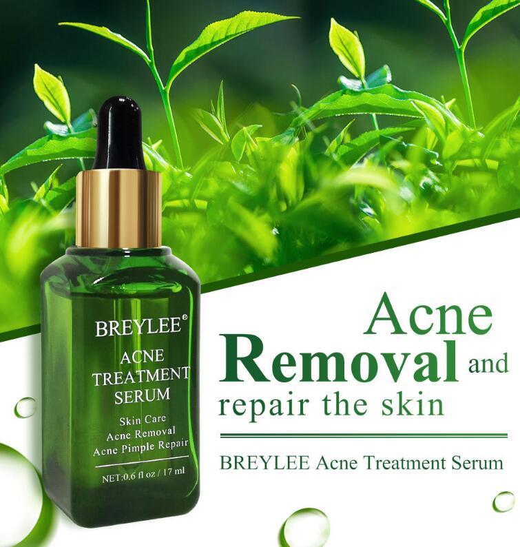Acne Treatment Serum – Facial Repair Oil for Clear, Healthy Skin