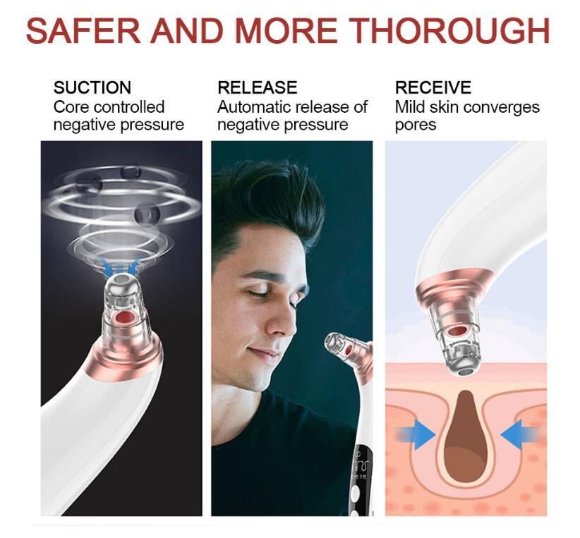 USB Electric Blackhead Remover – Visual Pore Cleaner with LED Display