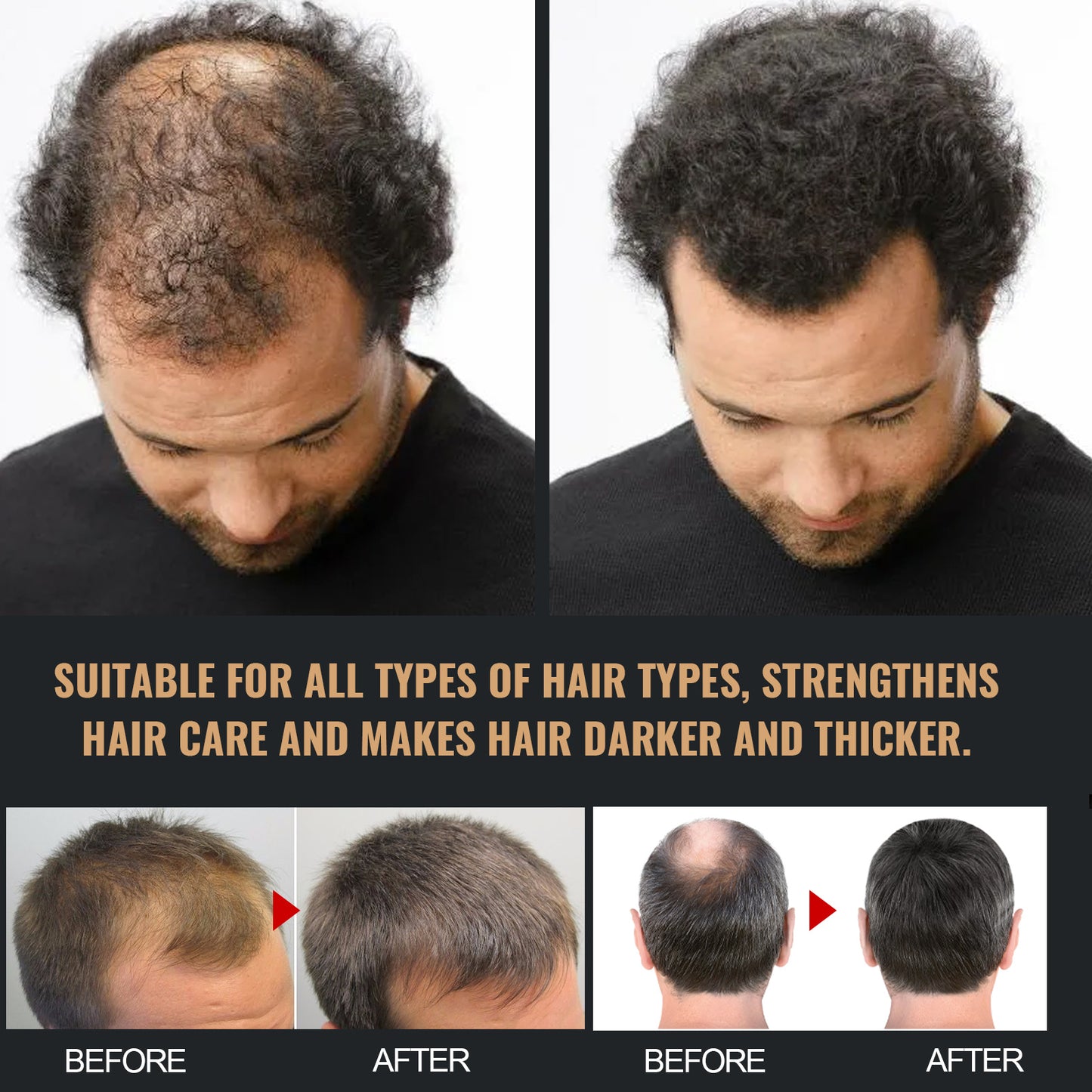Root Activator Hair Regrowth Shampoo – Natural Thickening & Nourishing Formula